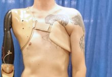 Prosthetic arm technology that detects spinal nerve signals developed by team